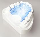 一般的な歯科矯正